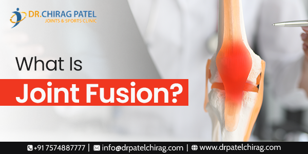 what is joint fusion Surgery | arthrodesis